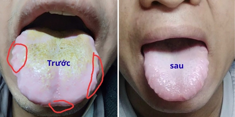 Anh Đức - Phú Quốc, Kiên Giang